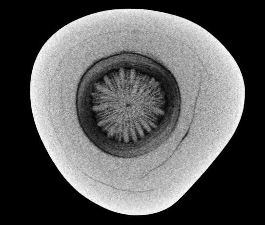 This natural pearl has an organic-looking core (thought to be coral) seen here through X-ray computed microtomography.